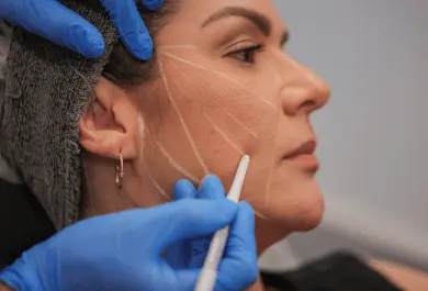 Fios de PDO Brasilia